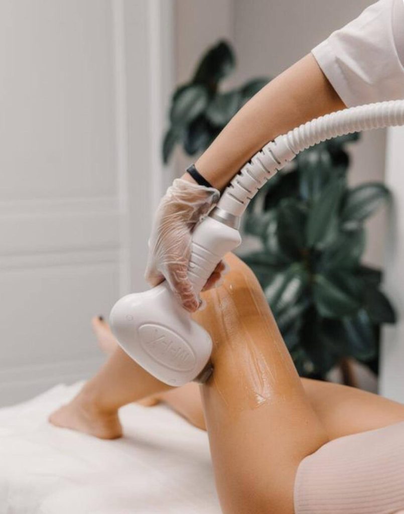 Épilation laser photo 18 2025 12 23 23 04 21