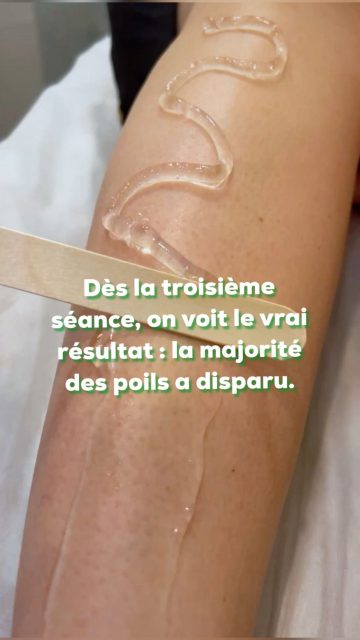 Après seulement 3 séances, le vrai résultat est là !
La plupart des poils ont déjà disparu, la peau est plus douce, plus lisse… et surtout : les clientes repartent avec le sourire.
Chez Epiluxe, on mise sur l’efficacité et le confort, séance après séance. 🌿💛

📍 Lyon 6 — 101 rue Garibaldi
📲 07.83.81.33.67 ou
07.82.93.36.41
💎 Institut 100% féminin #lyon #lyon6 #epilationdefinitivelyon